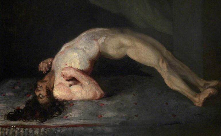 An infamous 1809 painting by Sir Charles Bell shows the painful muscle spasms of tetanus